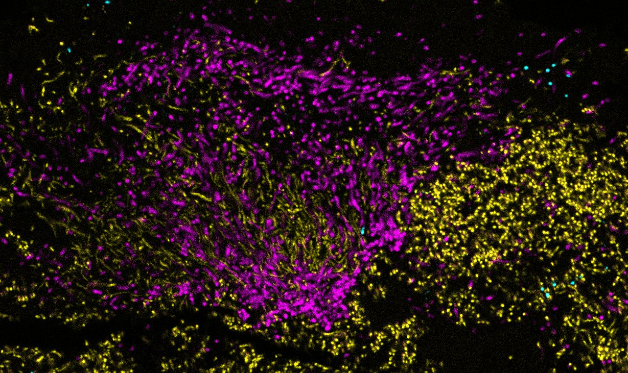 Actinomyces Image